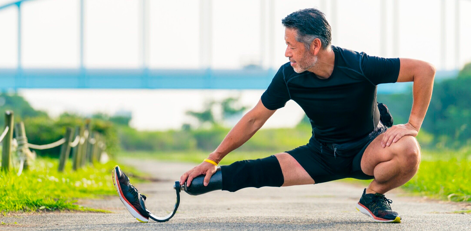 Man with Prosthetic Leg